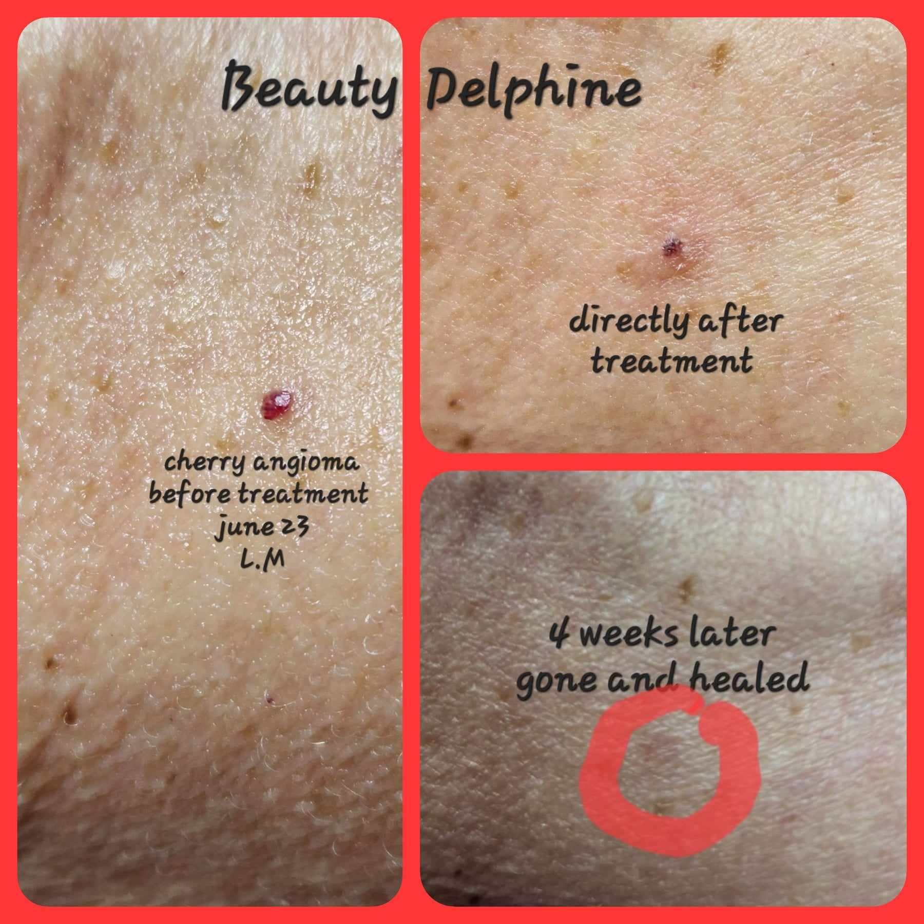 Beauty Therapy, guinot, Beauty Delphine Melbourne, Elthams Skin C